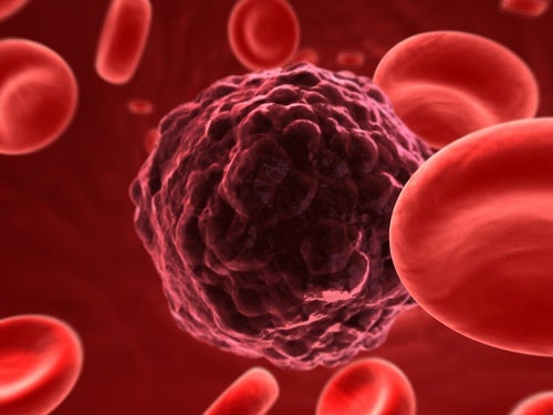 Avance médico podría eliminar las células cancerosas