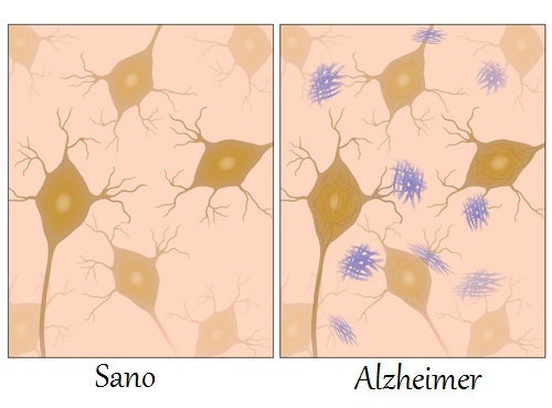 Alimentos para combatir el Alzheimer