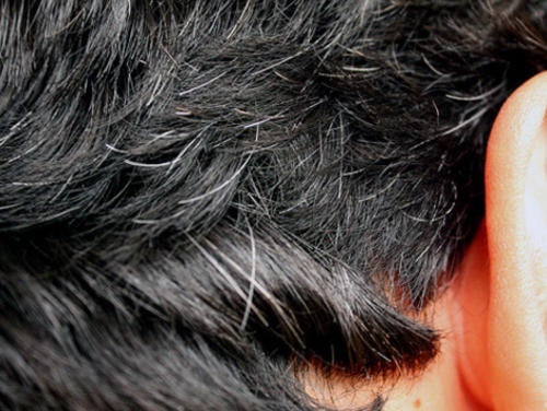 6 home remedies to fight early gray hair