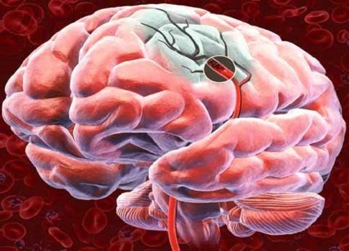 Descubre 5 formas para favorecer el flujo sanguíneo cerebral