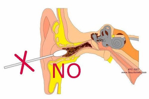 6 remedios caseros para la eliminación de la cera del oído