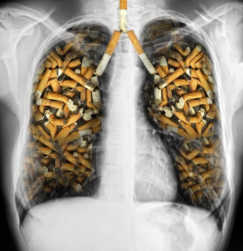 Pulmones cigarros