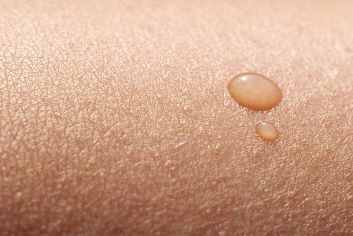 Remedios caseros para la piel reseca — Mejor con Salud