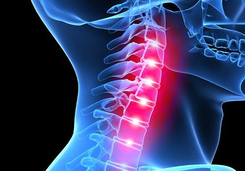 Cómo cambia nuestra columna vertebral debido al estrés