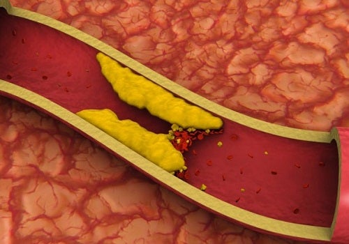 Resultado de imagen para colesterol