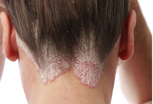 Life-Threatening Skin Rashes Causes ... - eMedicineHealth