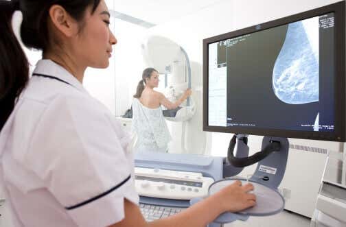 Mamografia e calcificações mamárias 