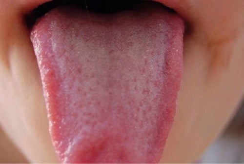 Descubre lo que dice tu lengua sobre tu salud