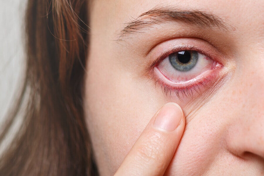 5 remedios para el síndrome del ojo seco — Mejor con Salud