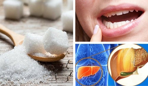 8 problemas de salud que ocasiona comer demasiado azúcar — Mejor ...