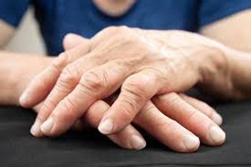 nueva-forma-de-tratar-la-artritis