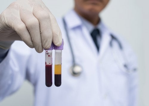 Différence entre le sérum et le plasma sanguin