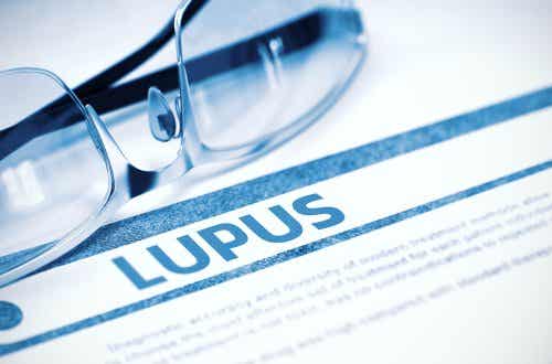 Risikofaktoren für Lupus