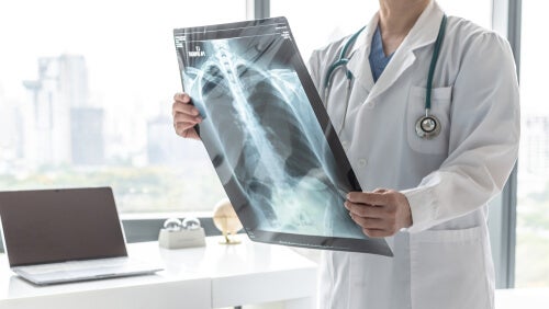 radiografía de tórax en paciente con asma