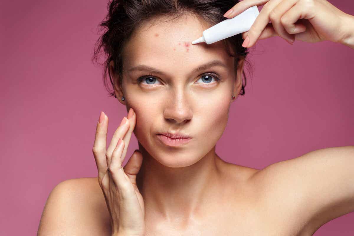A woman treating acne.